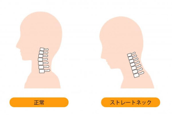 浅草　ロック座
